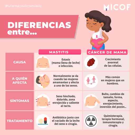 Diferencias entre mastitis y cáncer