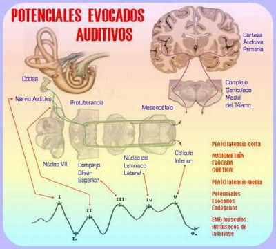 Potenciales evocados auditivos