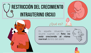 Restricción del crecimiento intrauterino (RCIU)